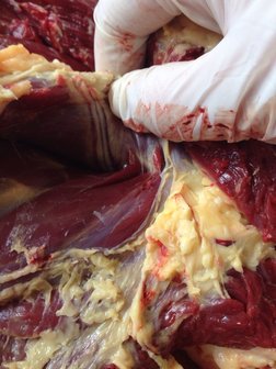 Dissectie